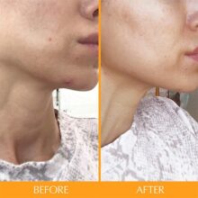 d8a7d8b3daa9d8a7db8cd986 d8aad8a7d985db8cd986 d987db8cd8b1d8aad8a7d985db8cd986 hairtamin skintamin 65a860bdd7b99